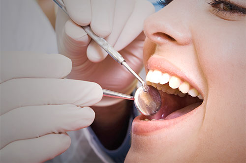 Make Dental Cleanings Part of Your Oral Health Plan