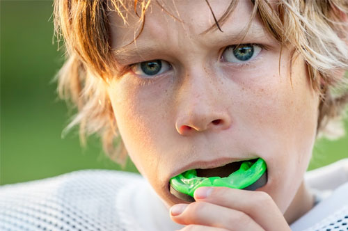 Get Your Loved Ones’ Custom Mouthguards With Their Sports Gear