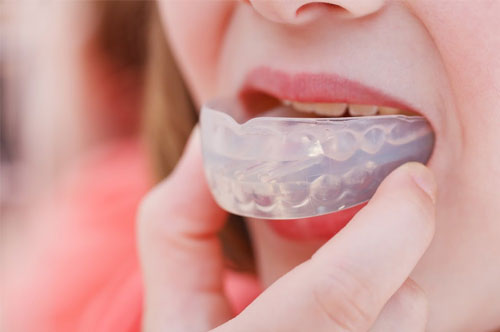 Get Your Athletic Mouthguard Now!